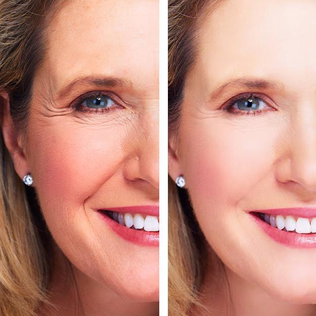 Age Perfect Night Repair Set