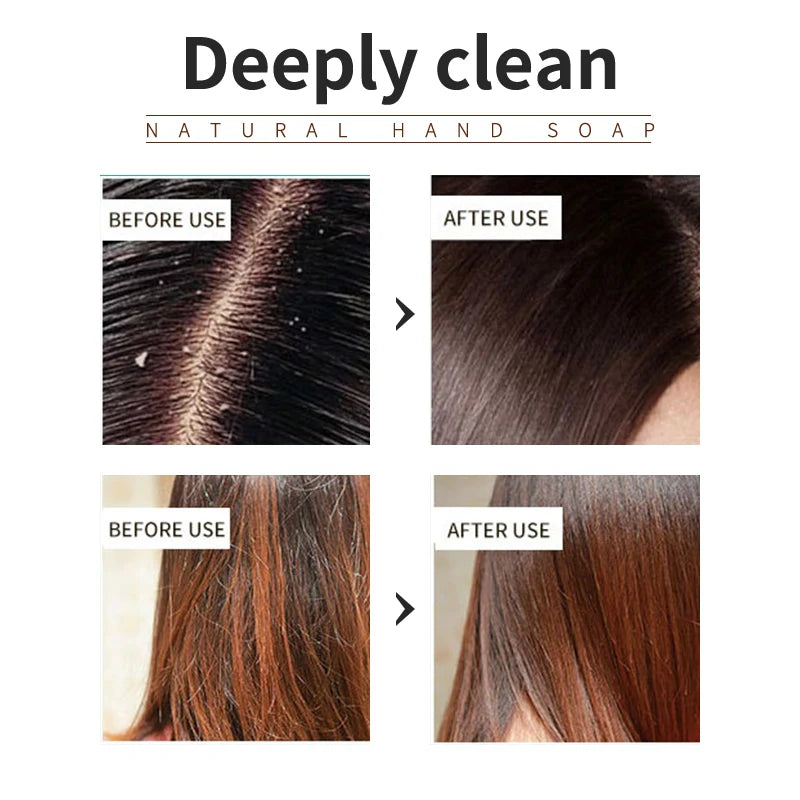 Lavender Scalp Reset