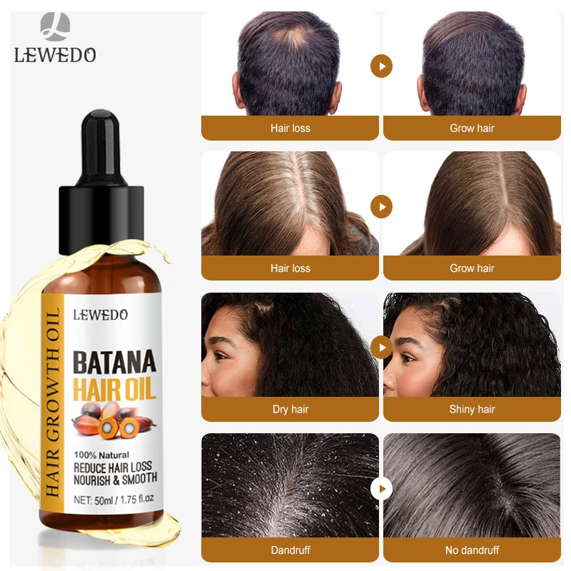 Fast-Grow Batana Hair Shot
