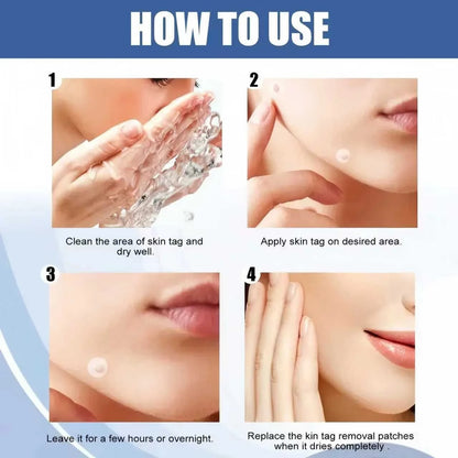 Stellar Skin Dots