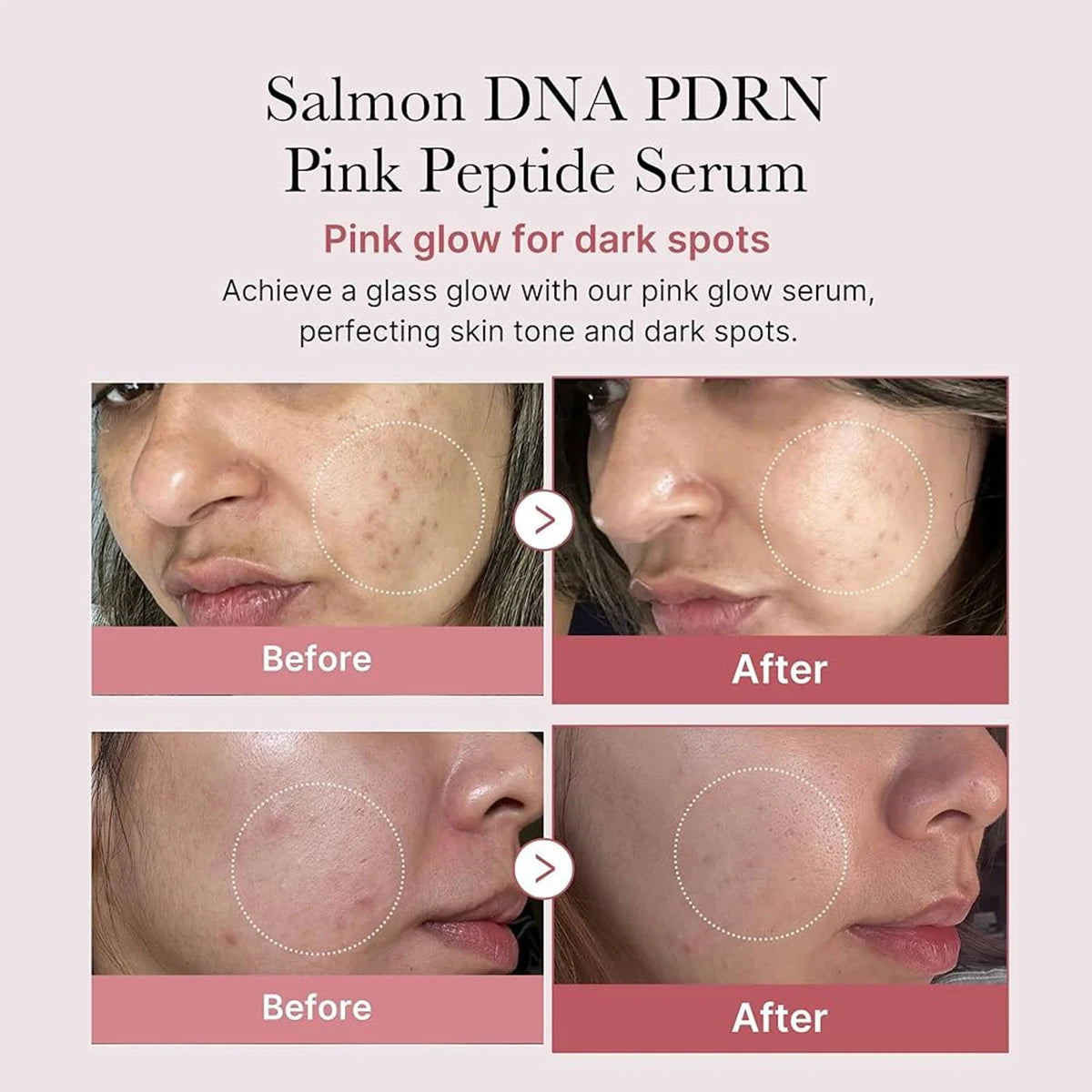 Medicube Salmon PDRN Serum