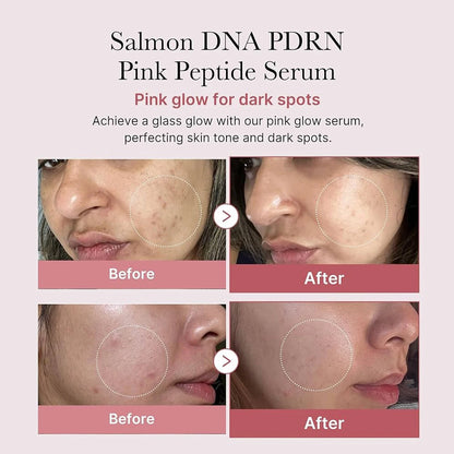 Medicube Salmon PDRN Serum