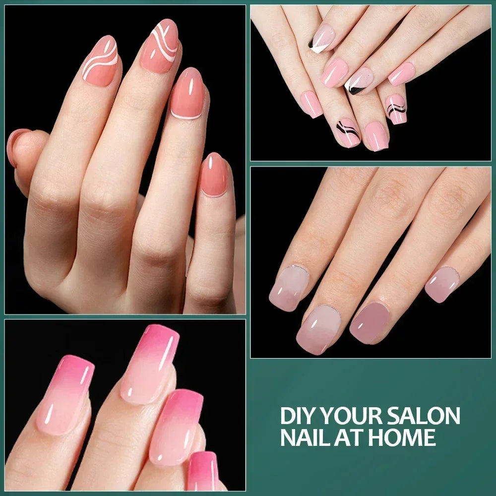 Pre-Etched Soft Gel System