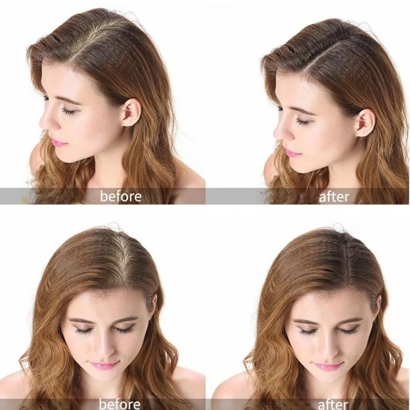 GingerGrow Hair Care Kit