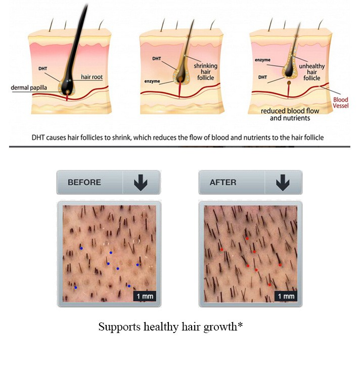 GingerGrow Hair Care Kit