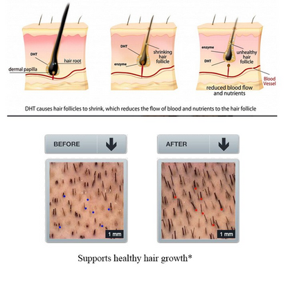 GingerGrow Hair Care Kit