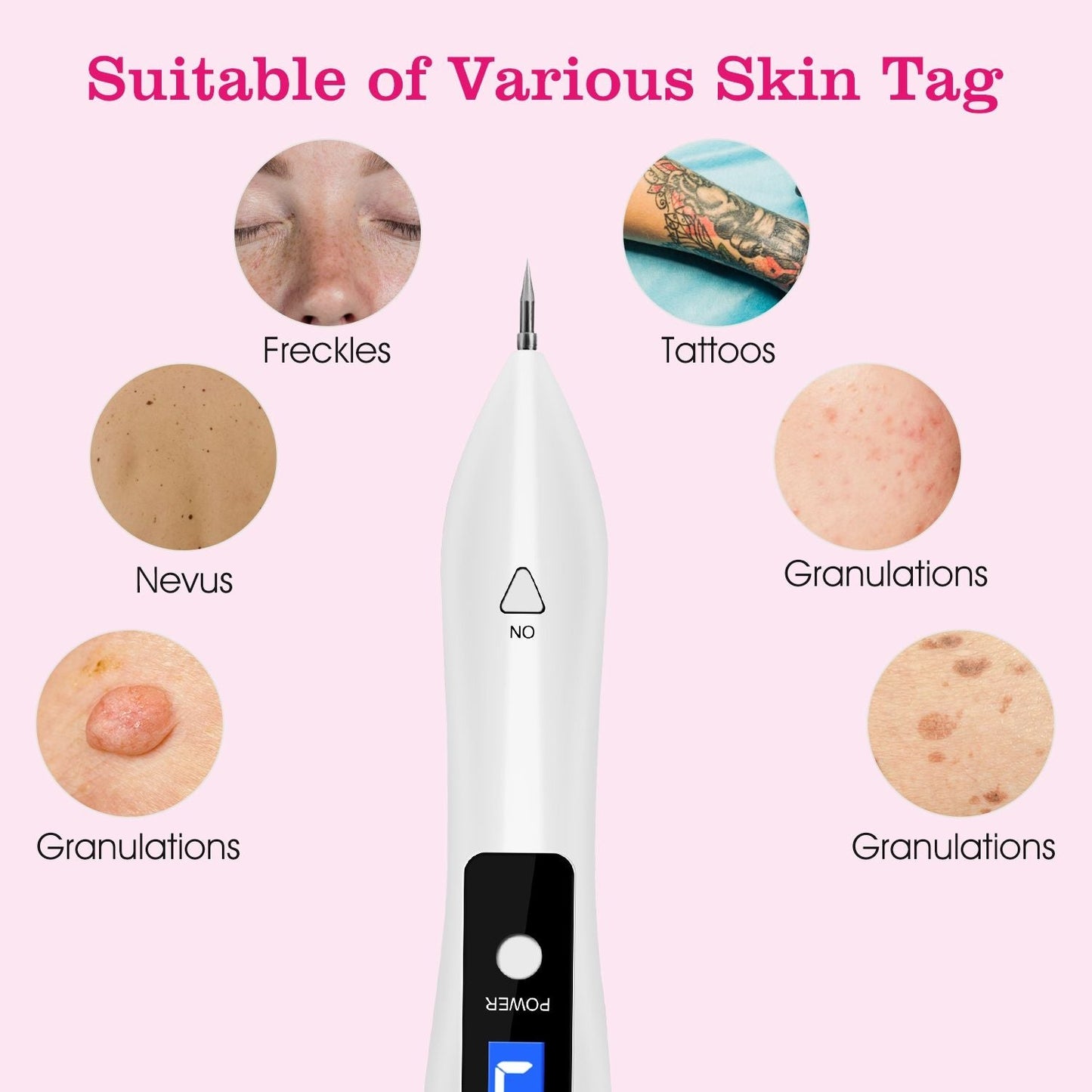 Portable Skin Tag Repair Kit